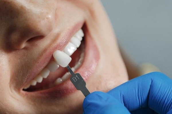 artikel 3 dental